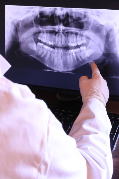 Best Emergency Denture Repair in Corning, IA