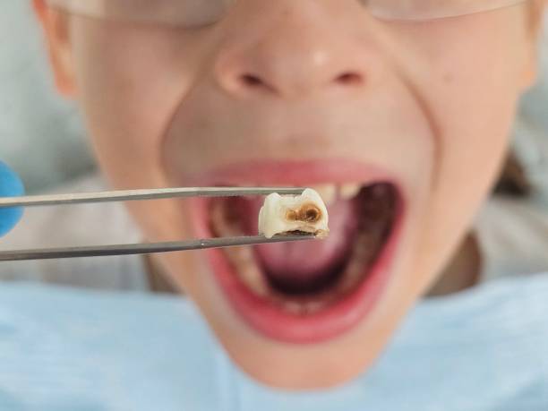 Best Emergency TMJ Treatment in Corning, IA