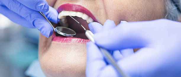 Best Emergency Tooth Extraction in Corning, IA